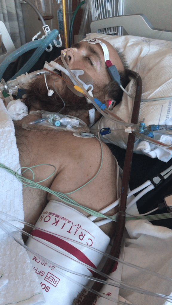 Adam on ECMO Life Support